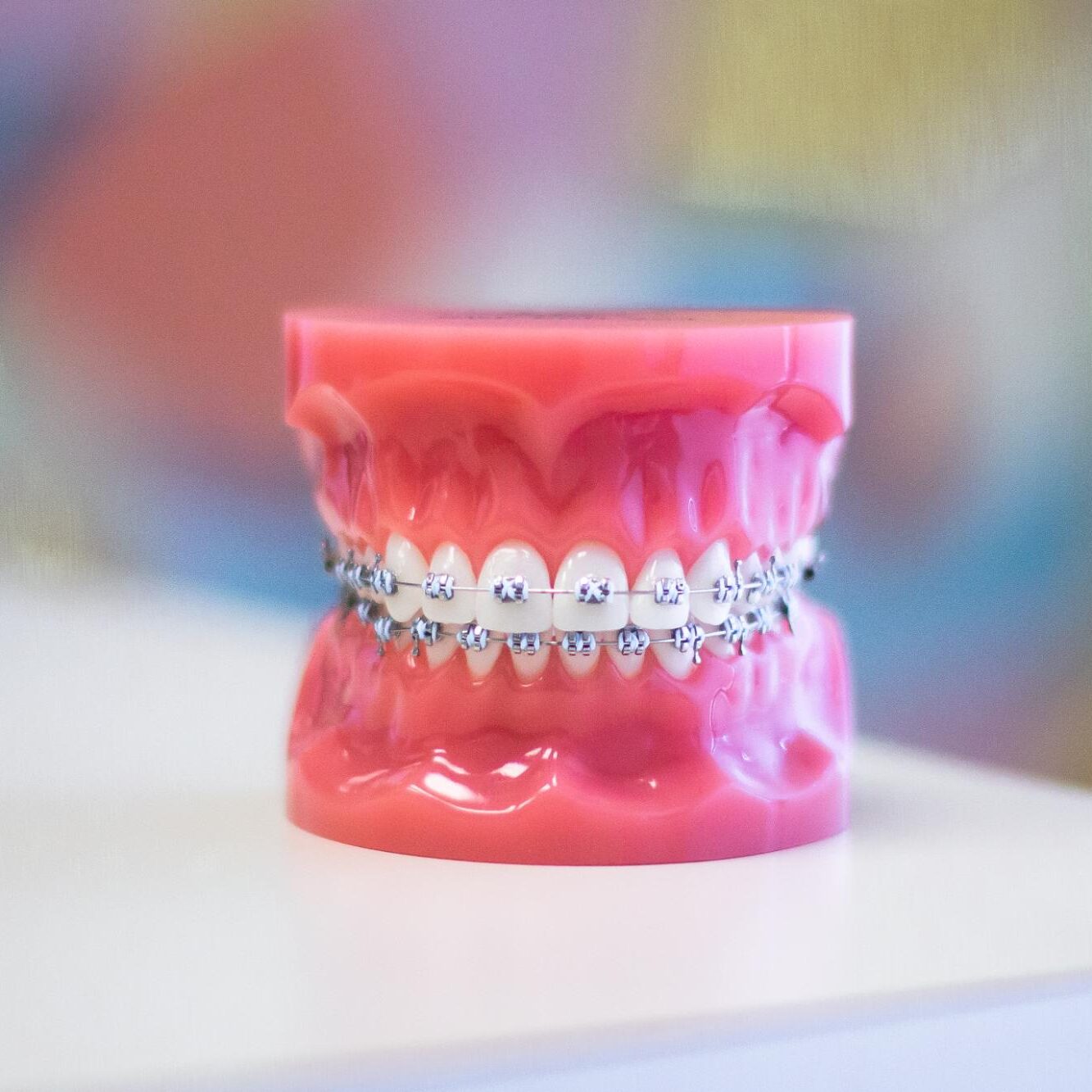 Metal Braces